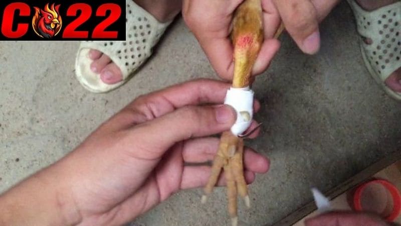 Kỹ thuật băng cựa gà là gì?